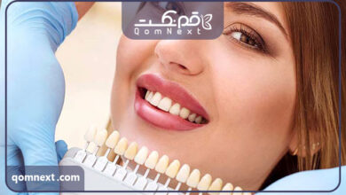 بهترین دکتر کامپوزیت در قم