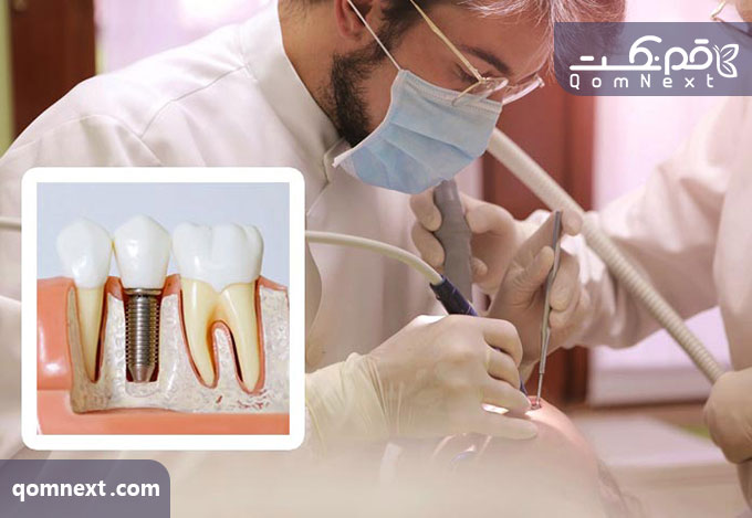 ایمپلنت دندان چه معایبی دارد؟