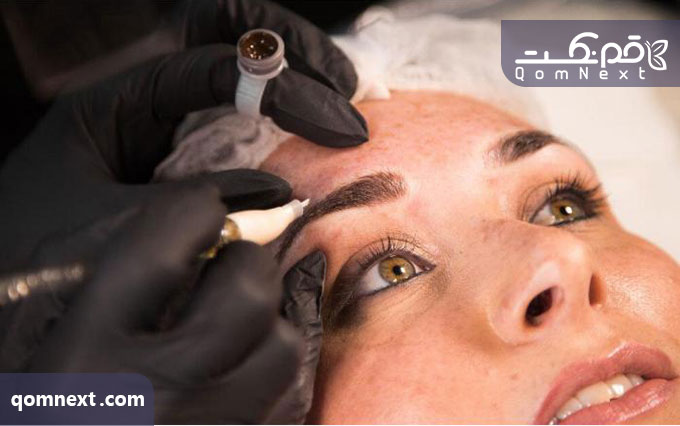 میکروبلیدینگ در چه مواقعی نباید انجام شود؟
